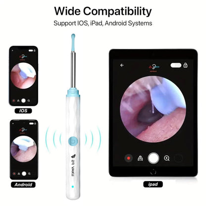 EarScope™ Smart Cleaner 👂✨
